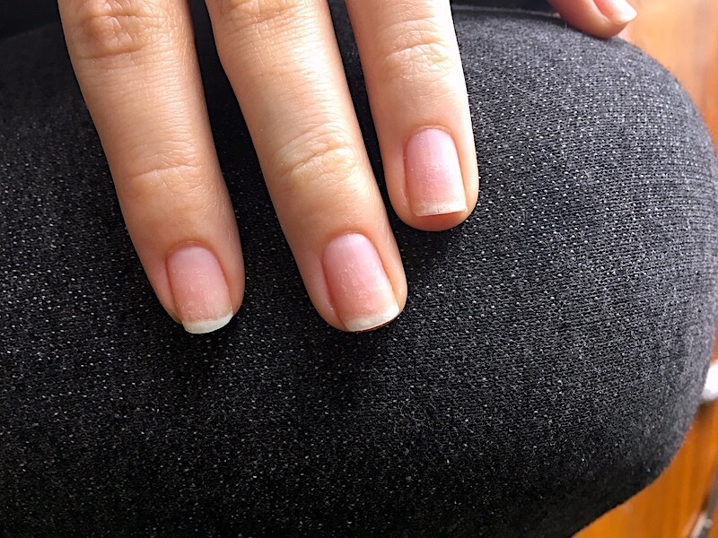 Nageldiagnostik